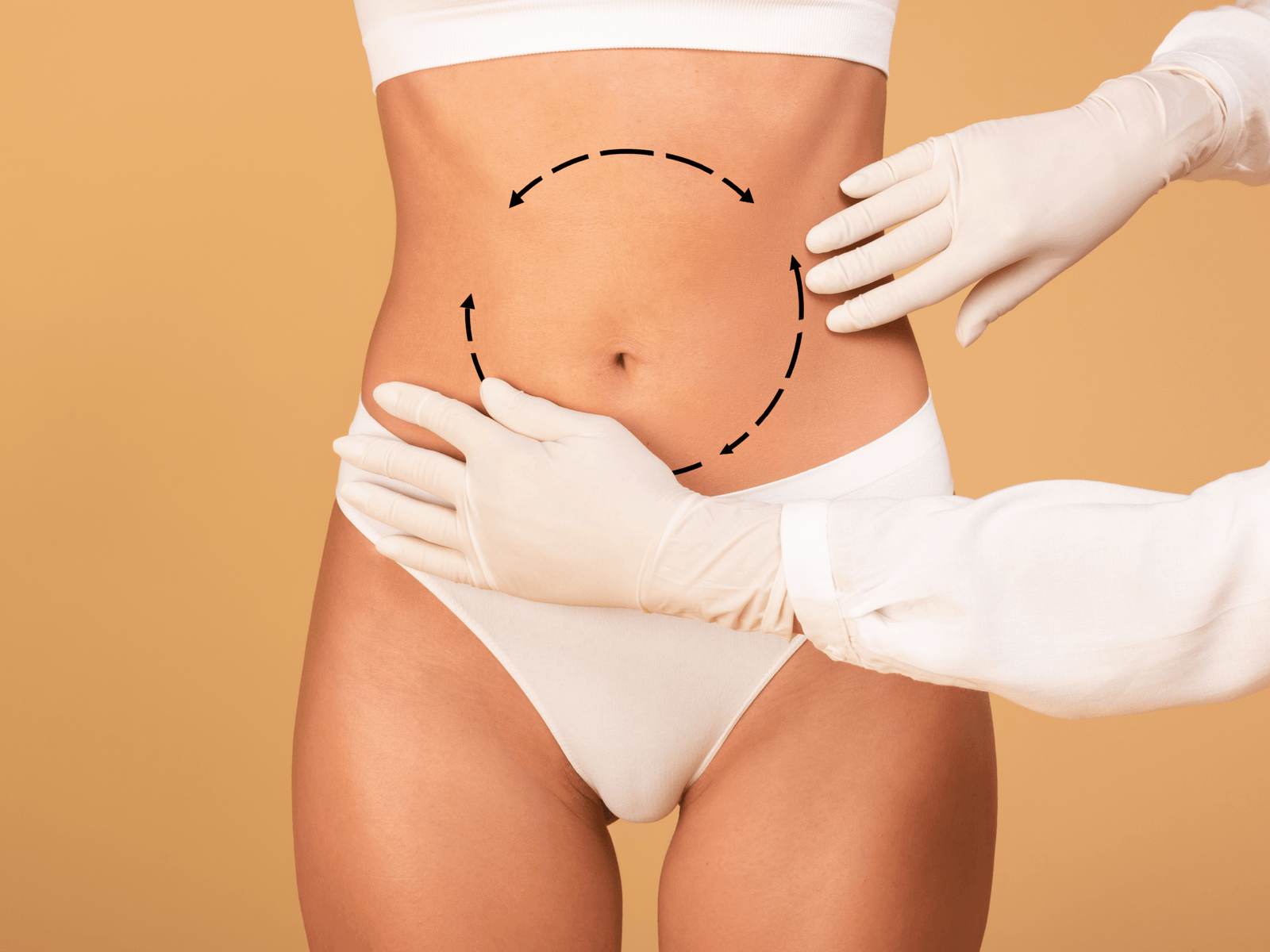 Liposuction