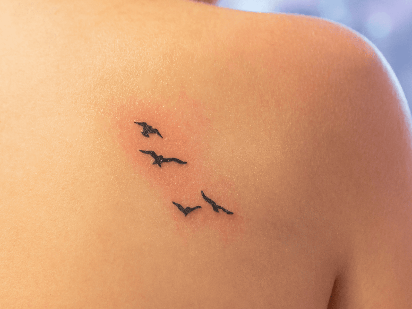 Scar Modification
