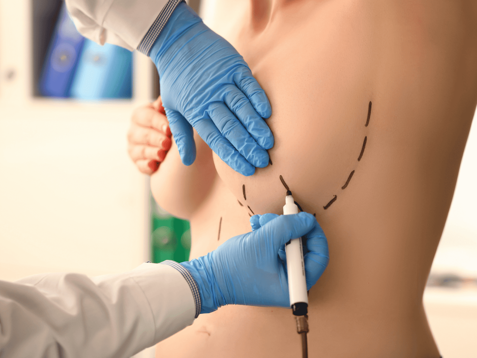 Breast Surgeries
