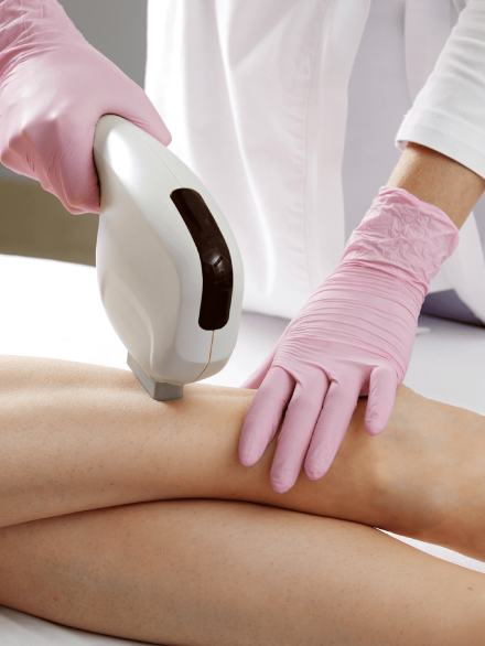 Laser Hair Removal